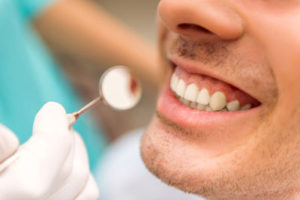 Gum Disease Lead To Oral Cancer