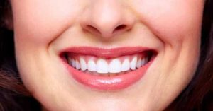 cosmetic dental procedures