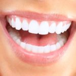 Popular Cosmetic Dentistry Procedures